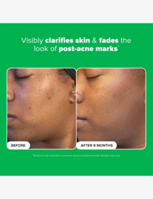 Paula's Choice S Choice 10% Azelaic Acid Booster 30ml