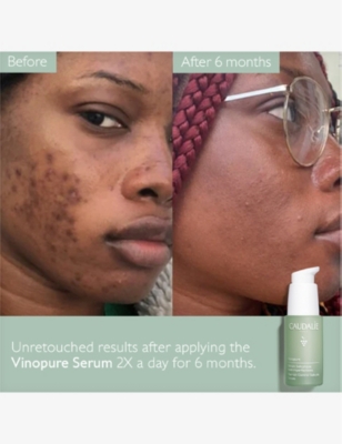 Caudalíe Vinopure Blemish Control Infusion Serum 200ml